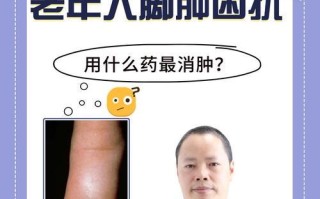 狗狗脚肿了怎么消肿？（探讨狗狗脚肿的原因和有效的消肿方法）