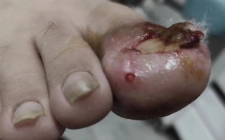 猫咪剪指甲流血了会自愈吗？（了解猫咪指甲剪伤的处理方法及预防措施）